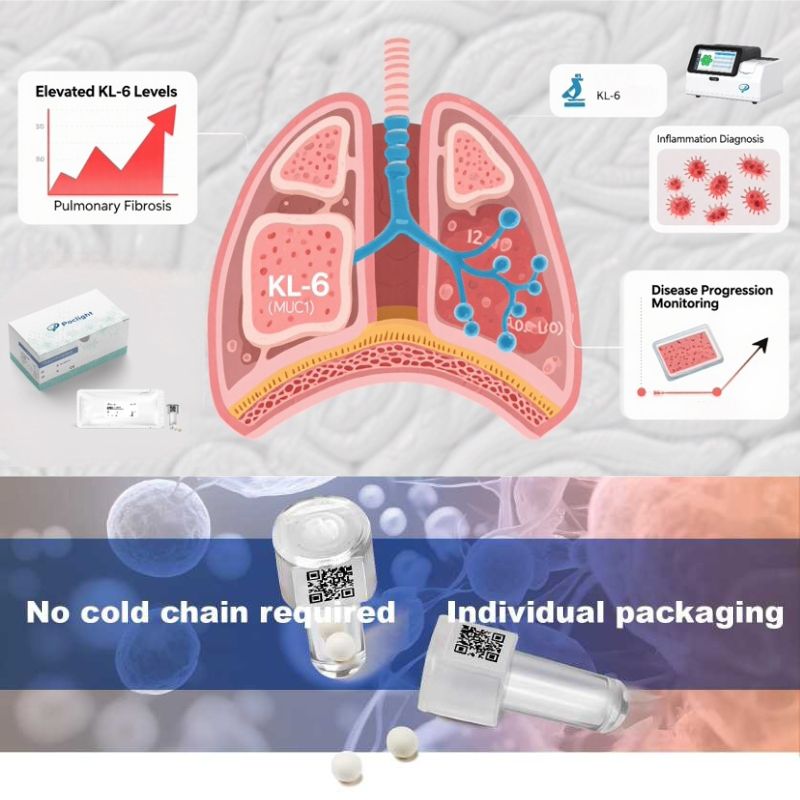 Cost-Effective KL-6 Test Kits with Clinical-Grade Performance